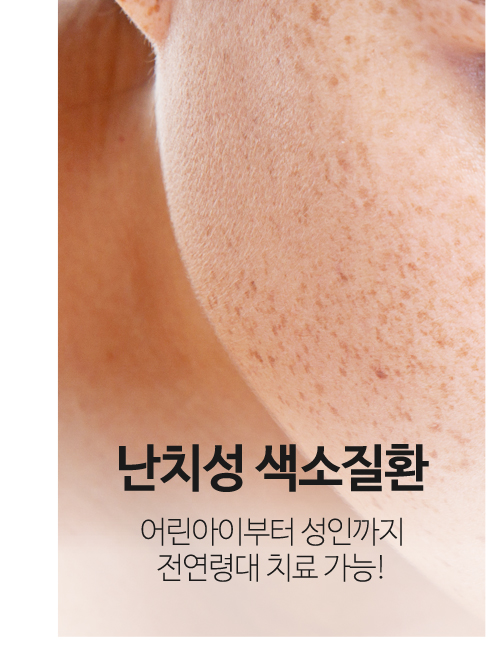 난치성 기미